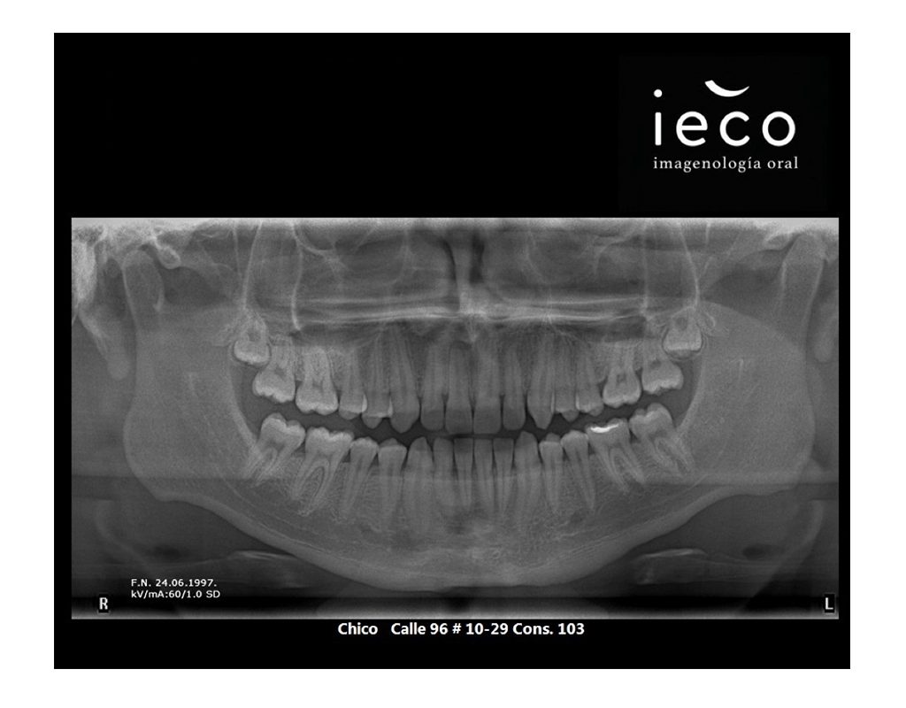 ieco1-1024x800